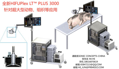 Sonic Concepts HIFUPlex LT? PLUS 3000